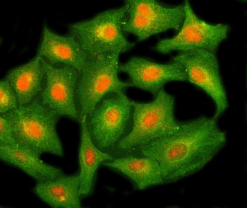 Anti-NHP2 Antibody