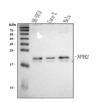 Anti-NHP2 Antibody