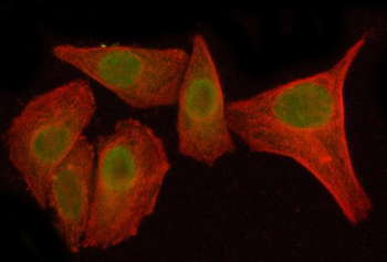 Anti-NFKBIZ Antibody