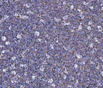 Anti-CCL15 Antibody