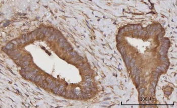 Anti-CCL23 Antibody