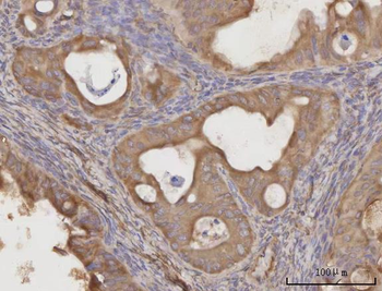 Anti-CCL23 Antibody