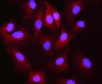 Anti-BLVRB Antibody