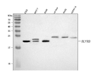 Anti-BLVRB Antibody