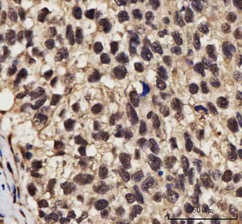 Anti-NELFE Antibody