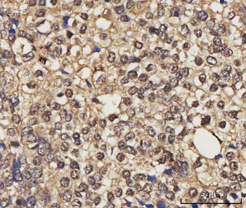 Anti-NELFE Antibody