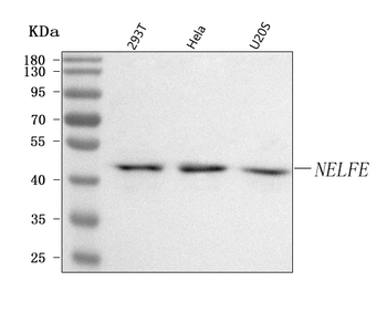 Anti-NELFE Antibody
