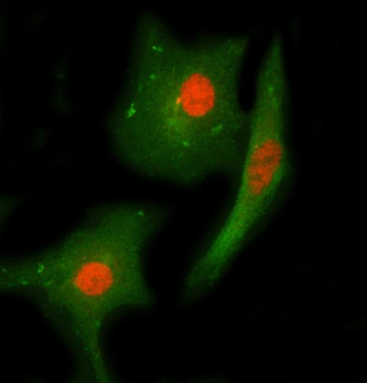 CHEK2 Rabbit Polyclonal Antibody