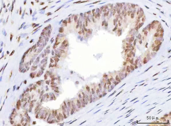 Anti-HOXD10 Antibody