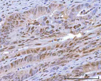 Anti-HOXD10 Antibody