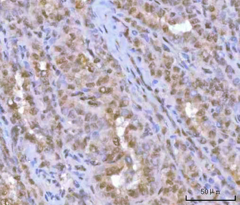 Anti-HOXD10 Antibody