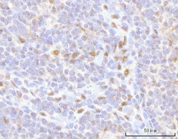 Anti-HOXD10 Antibody
