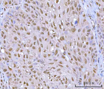 Anti-HOXD10 Antibody