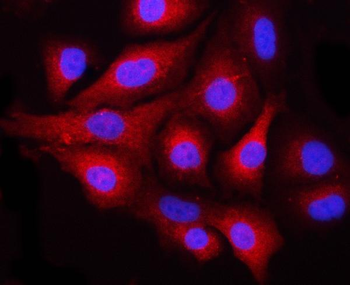 Anti-NEK6 Antibody