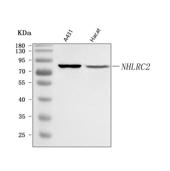 Anti-NHLRC2 Antibody