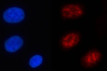Anti-NFRKB Antibody