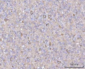 NECAB1 Antibody