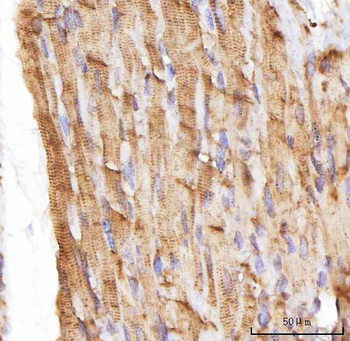 Anti-NEBL Antibody