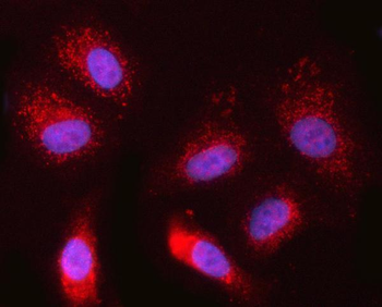 Anti-NR1/NDOR1 Antibody
