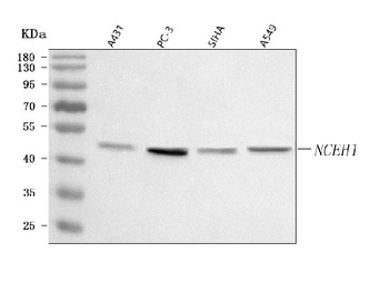 Anti-AADACL1/NCEH1 Antibody