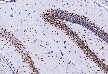 Anti-NCBP1 Antibody