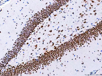Anti-NCBP1 Antibody