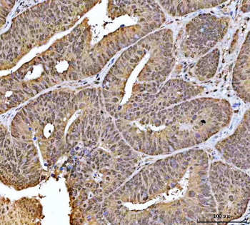 Anti-NCBP1 Antibody