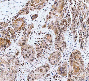 Anti-NCBP1 Antibody