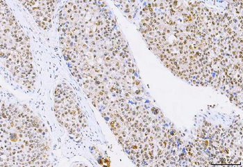 Anti-NCBP1 Antibody
