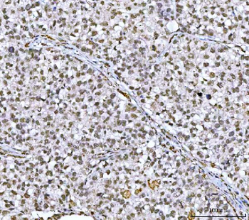 Anti-NCBP1 Antibody