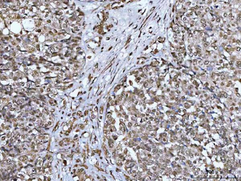 Anti-NCBP1 Antibody