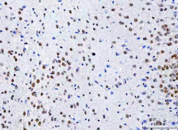 Anti-NCBP1 Antibody