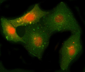 Anti-NCAPH Antibody