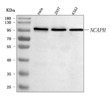 Anti-NCAPH Antibody