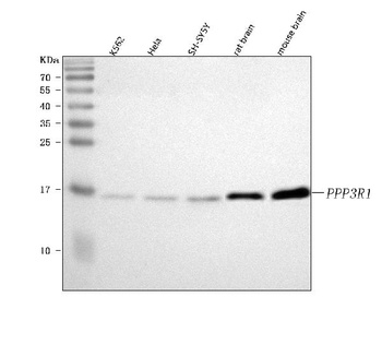 Anti-PPP3R1 Antibody