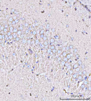 Anti-PPP3R1 Antibody