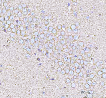 Anti-PPP3R1 Antibody