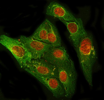 Anti-PRDM2 Antibody