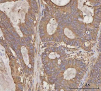 Anti-PRDM2 Antibody