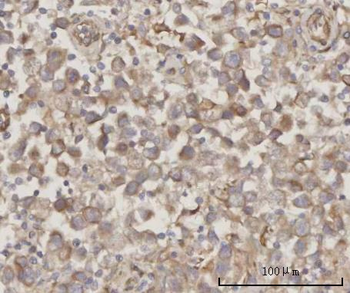 Anti-PRDM2 Antibody