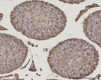 Anti-PRDM2 Antibody