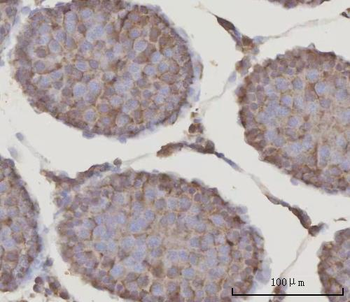 Anti-PRDM2 Antibody