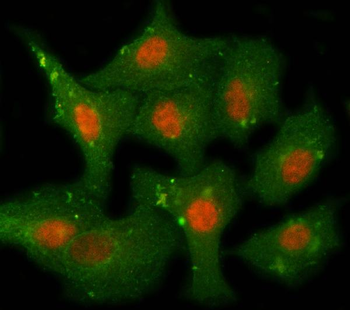 PPM1F Rabbit Polyclonal Antibody