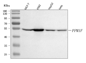 PPM1F Rabbit Polyclonal Antibody