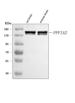 Anti-PPFIA2 Antibody