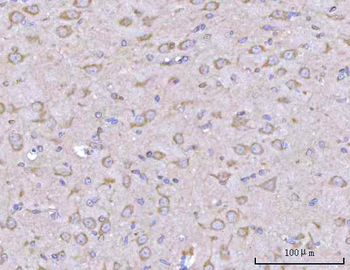 Anti-PPFIA2 Antibody