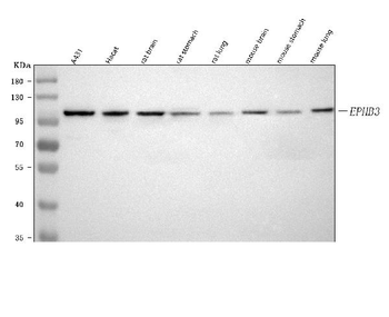 EPHB3 Rabbit Polyclonal Antibody
