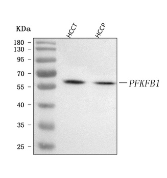 Anti-PFKFB1 Antibody