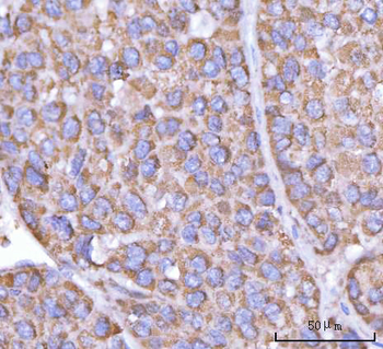 Anti-PFKFB1 Antibody