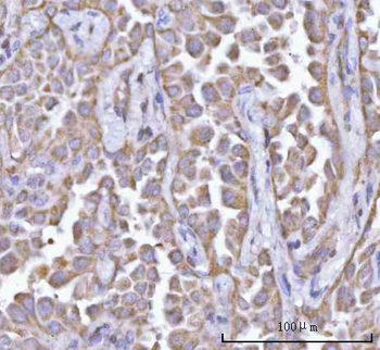 Anti-PFKFB1 Antibody